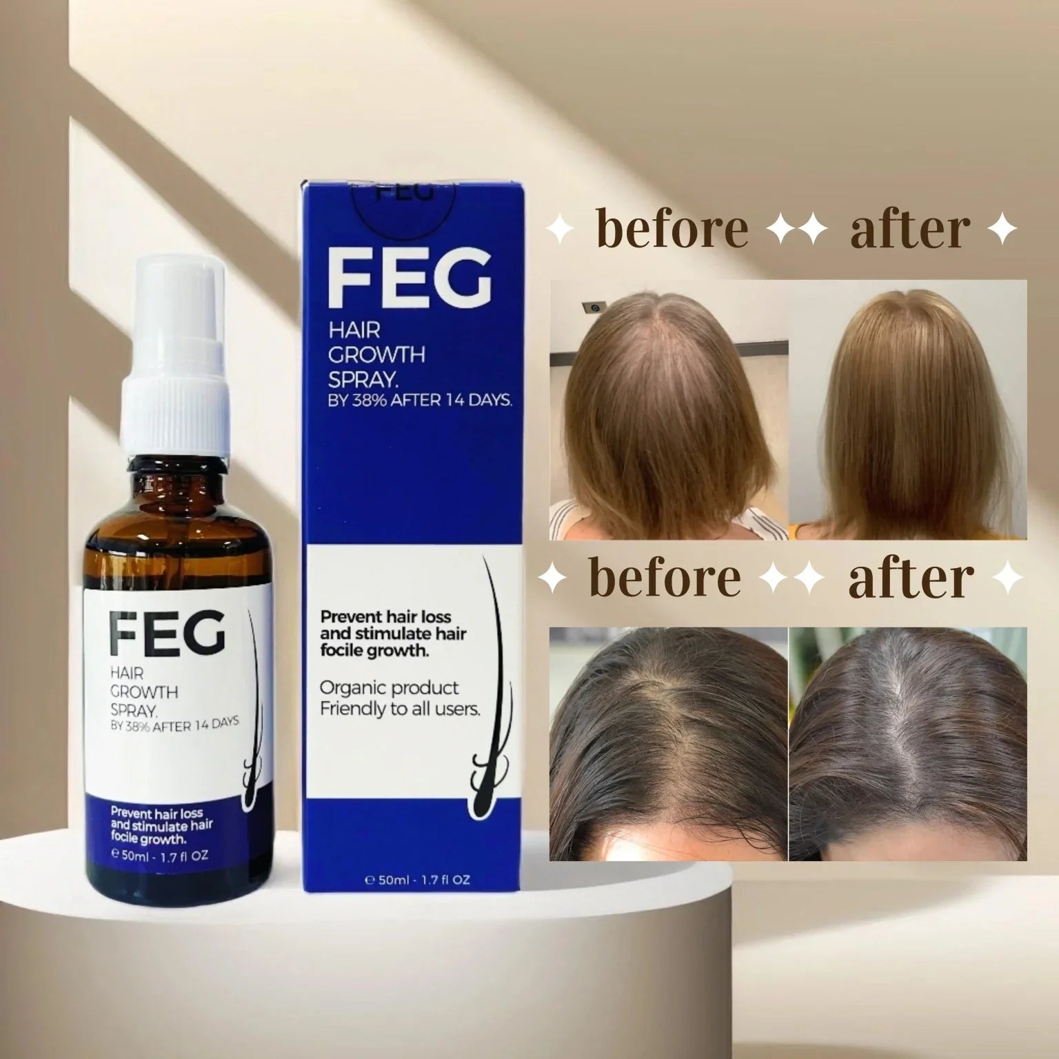 Feg Plus Hair & Beard Growth Serum Spray 50ml – Anti Hair Loss & Regrowth Treatment with Seaweed Extract, Rosemary, Redensyl, Anagain & Minoxidil